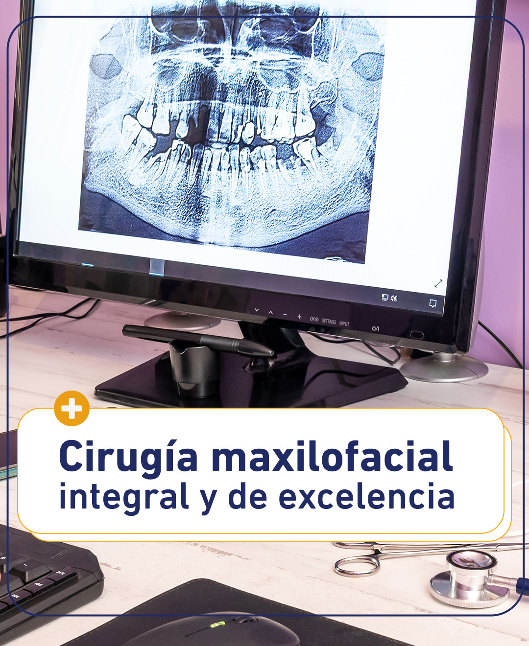 Conocé más sobre nuestra especialidad en cirugía maxilofacial